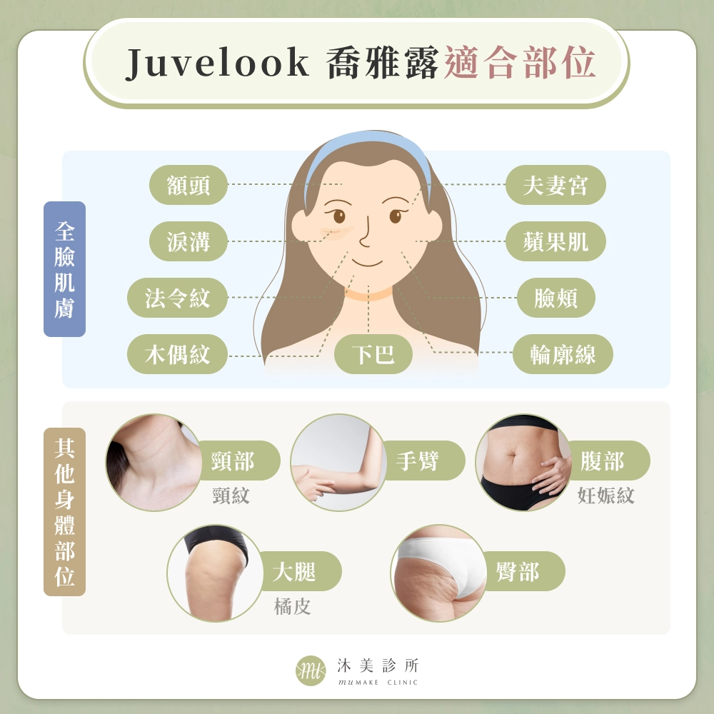 Juvelook 喬雅露適合部位