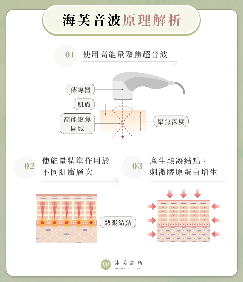 海芙音波原理解析