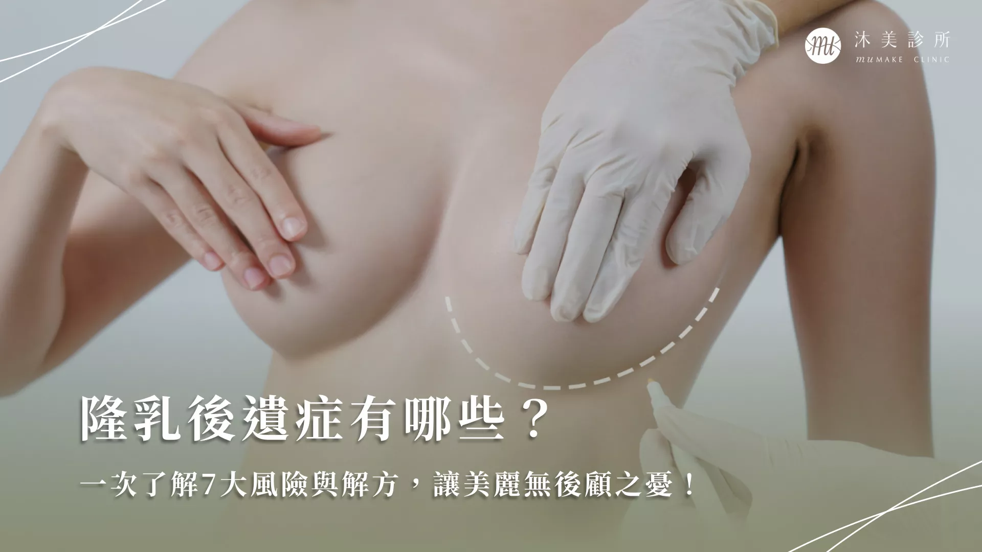 隆乳後遺症有哪些？一次了解7大風險與解方，讓美麗無後顧之憂！