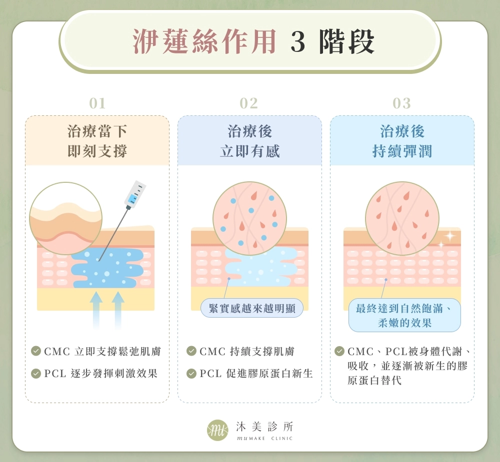 洢蓮絲作用 3 階段